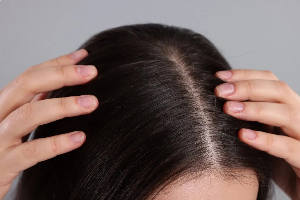 
                                                                                            ¿Por qué el cabello se vuelve graso y cómo prevenirlo? Consejos de expertos
                                             